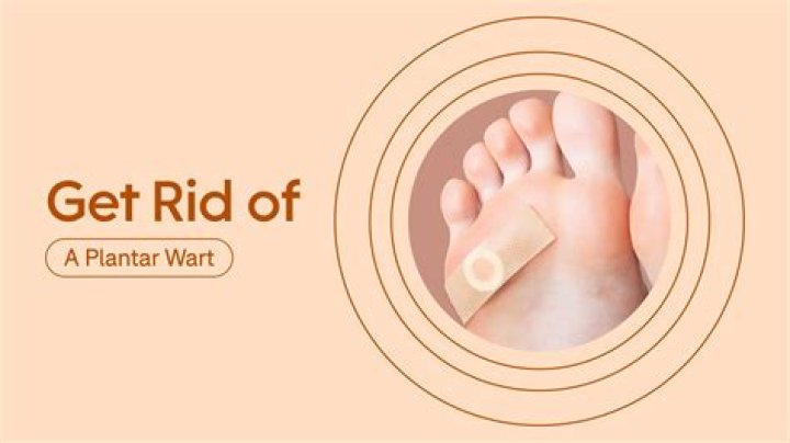 What is the fastest way to get rid of a plantar wart?