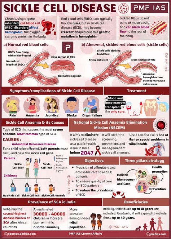 What is the medical management of sickle cell Anaemia?