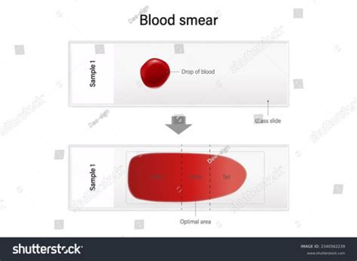 What is the purpose of blood smear?