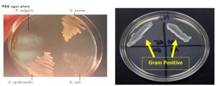 What is the purpose of Phenylethanol Agar?