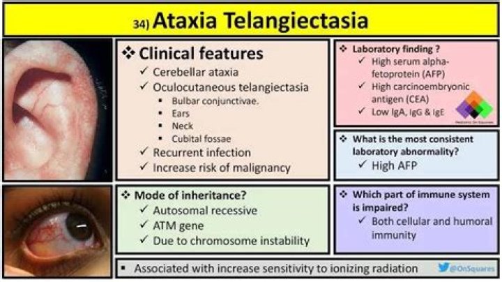 What is the treatment for ataxia telangiectasia?