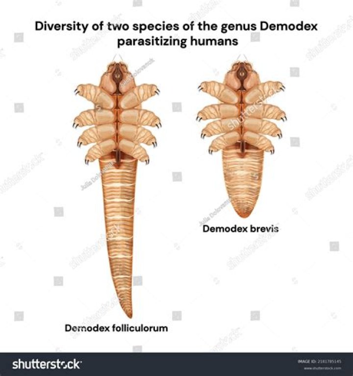 What kills Demodex mites in humans?