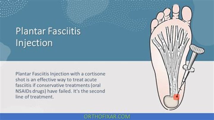 What type of surgery is done for plantar fasciitis?