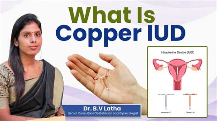 What was your experience with copper IUD?