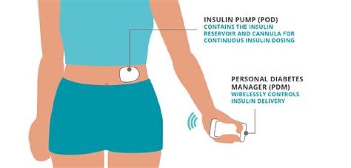 Where can I insert my Medtronic insulin pump?