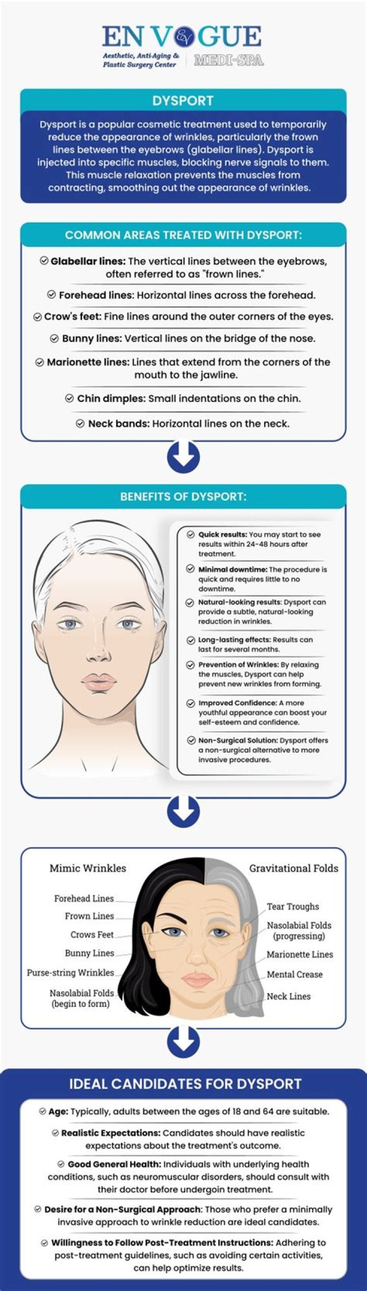 Where does Dysport work best?