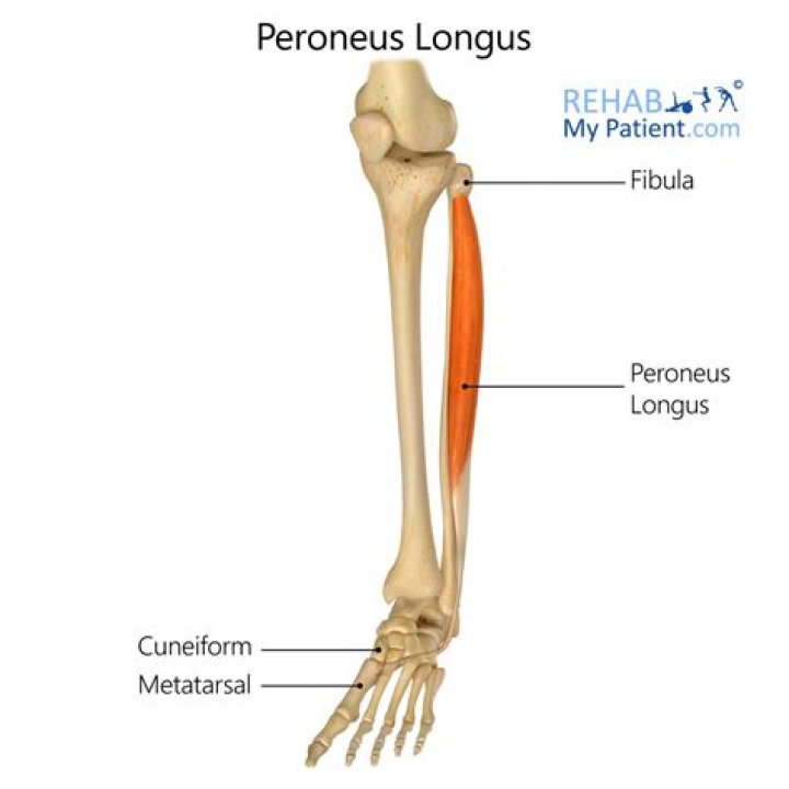 Why does my peroneus longus hurt?