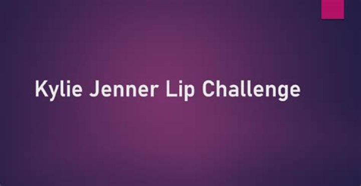 Why you should not do the Kylie Jenner lip challenge?